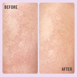 KP Bump Eraser Body Scrub with 10% AHA - Exfoliant pentru corp