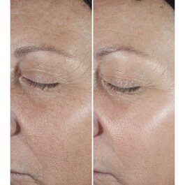 Smart Clinical Repair Serum - Serum antirid