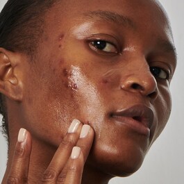 Solutie pentru controlul excesului de sebum cu 20% niacinamide - Ser pentru fata